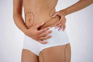 Yağ Alma (Liposuction) Tedavisi